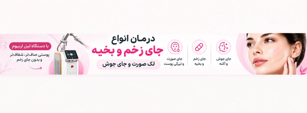تبلیغات لیزر اربیوم